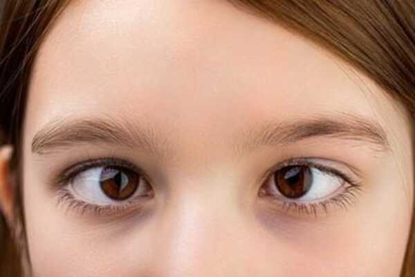 BEST EYE HOSPITAL IN KANPUR ADARSH EYE HOSPITAL WWW.ADARSHEYEHOSPITAL.COM BEST EYE SURGEON