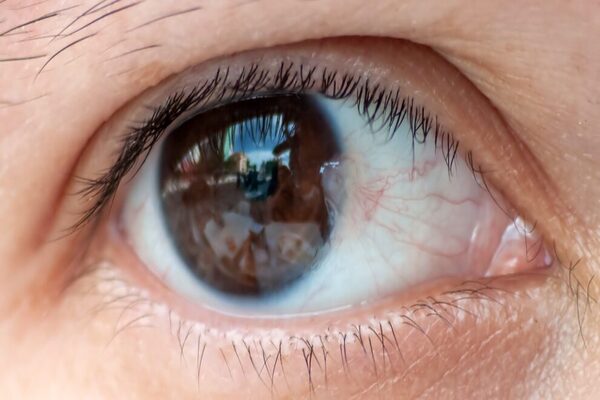 BEST EYE HOSPITAL IN KANPUR ADARSH EYE HOSPITAL WWW.ADARSHEYEHOSPITAL.COM BEST EYE SURGEON